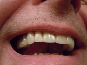 Dr David Samadi mens dental tips